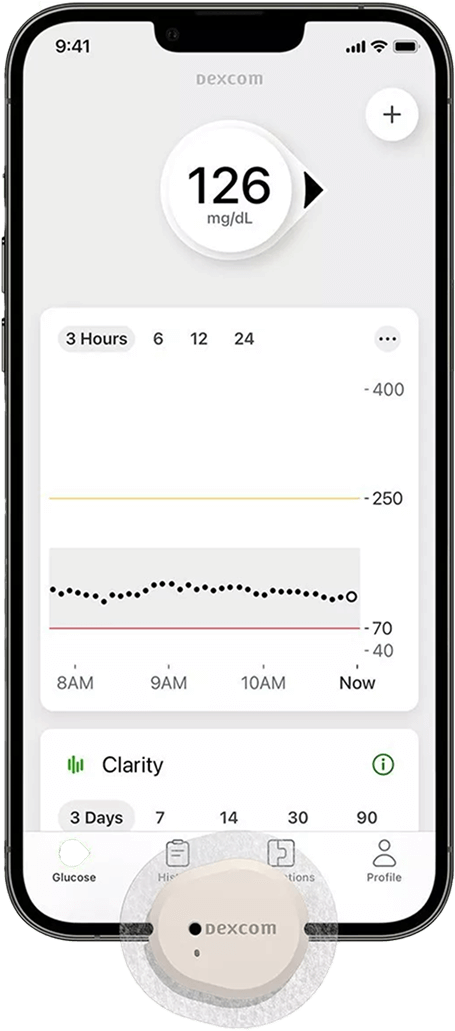 Dexcom G7